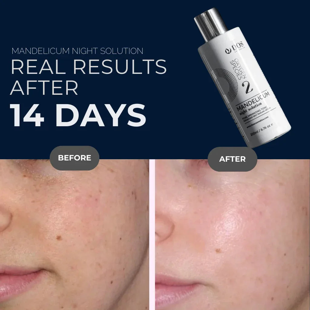 MANDELICUM | Light Exfoliating Night lotion - DOS Cosmetics